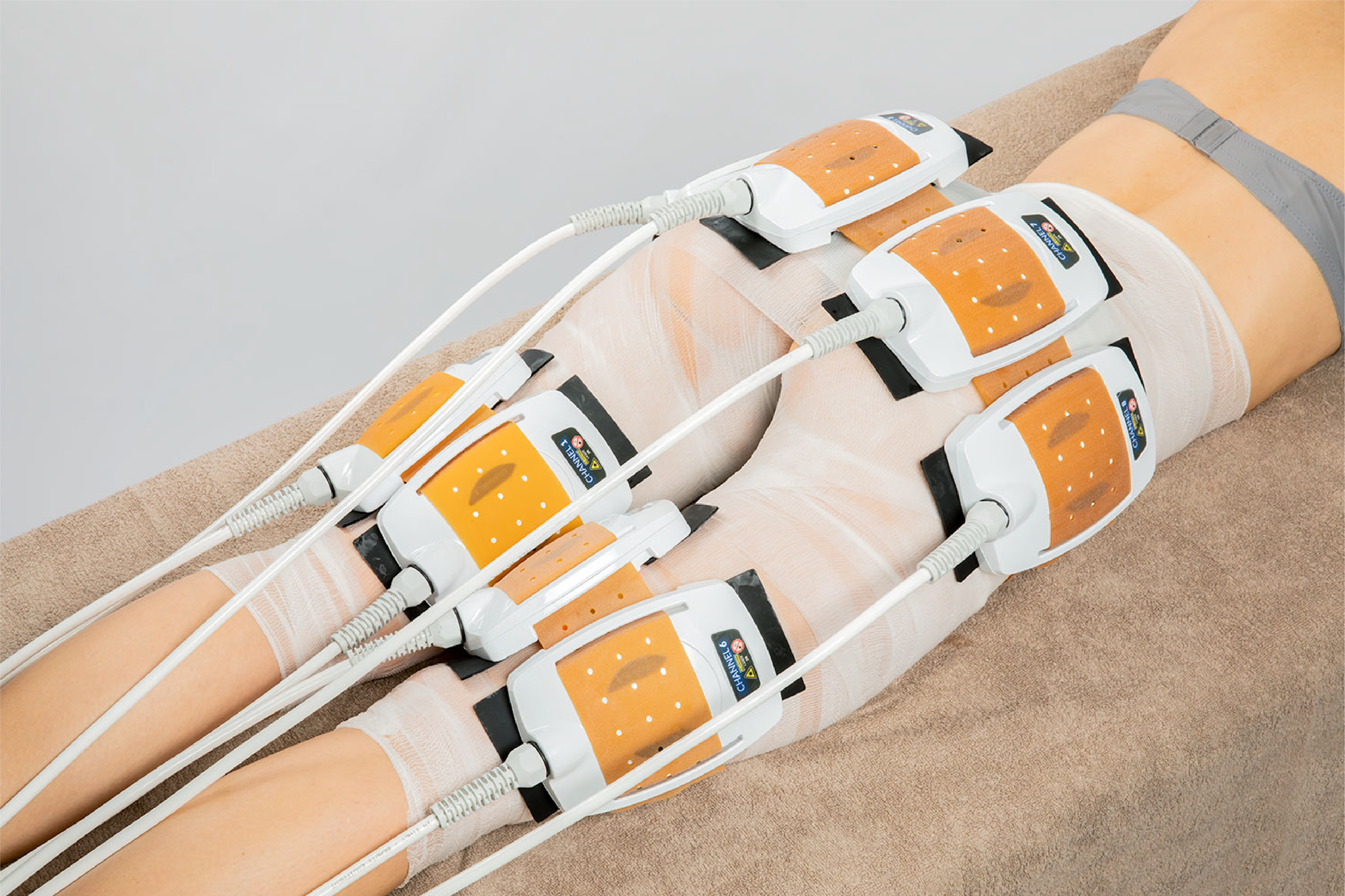 Body Synergy Laser 980 nm